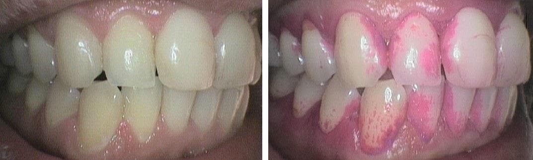 ¿Cómo cepillarse los dientes? - Imagen 1