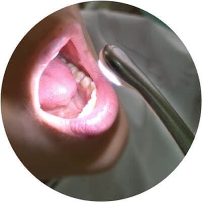 Cámara intraoral HD para registro dental fotográfico