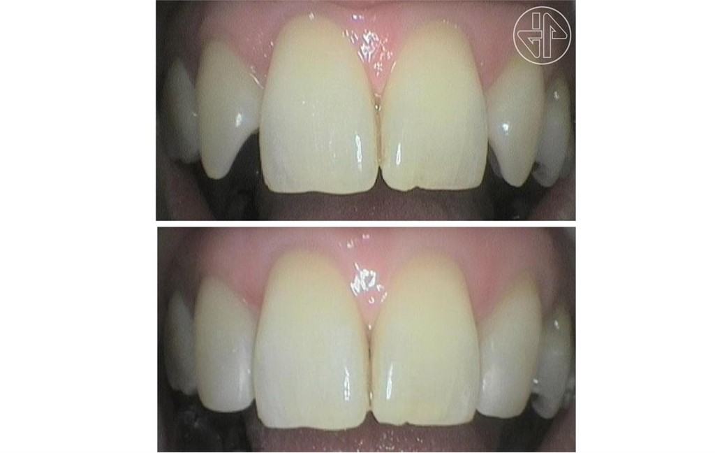 Transformación Dental