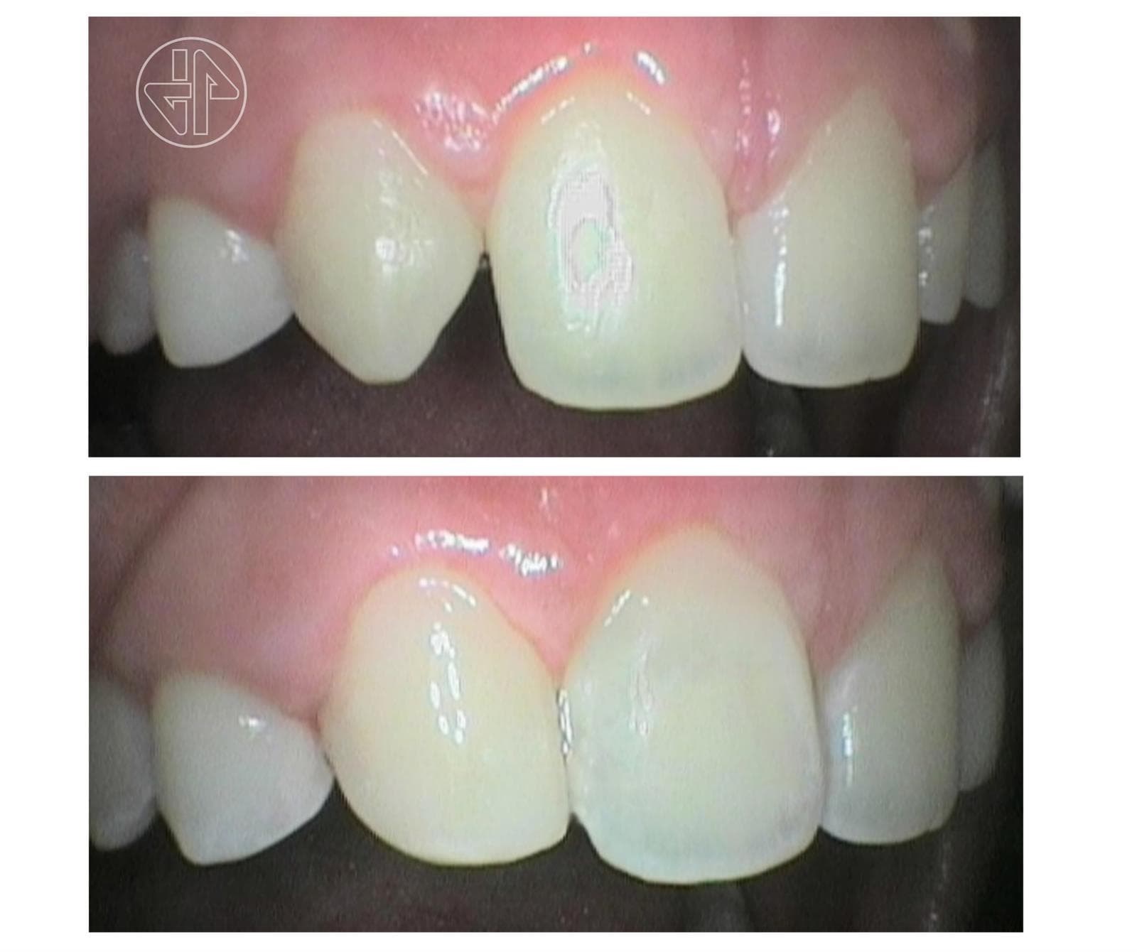 Transformación Dental - Imagen 10
