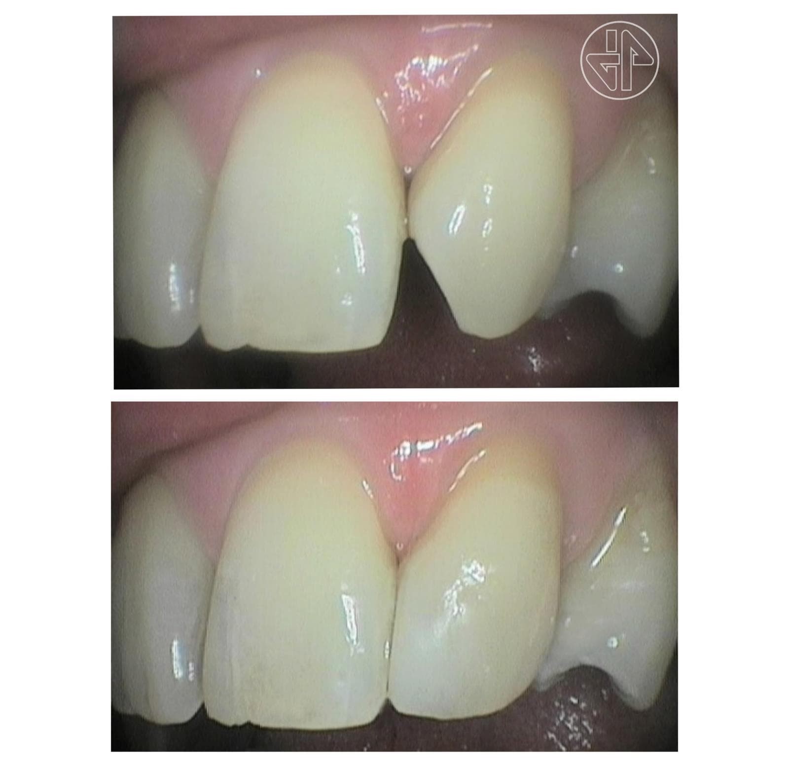 Transformación Dental - Imagen 9