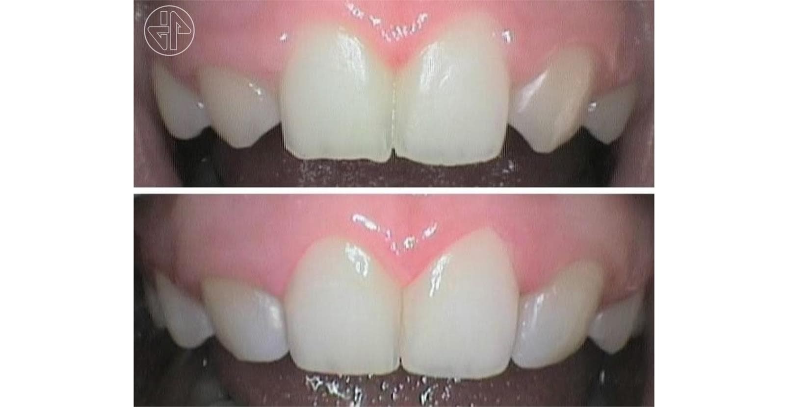 Transformación Dental - Imagen 8