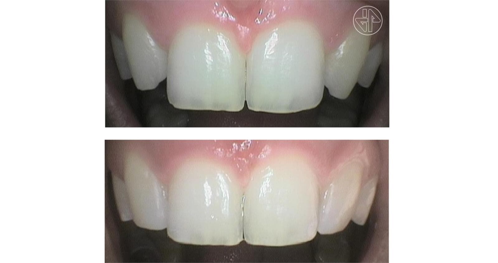 Transformación Dental - Imagen 6