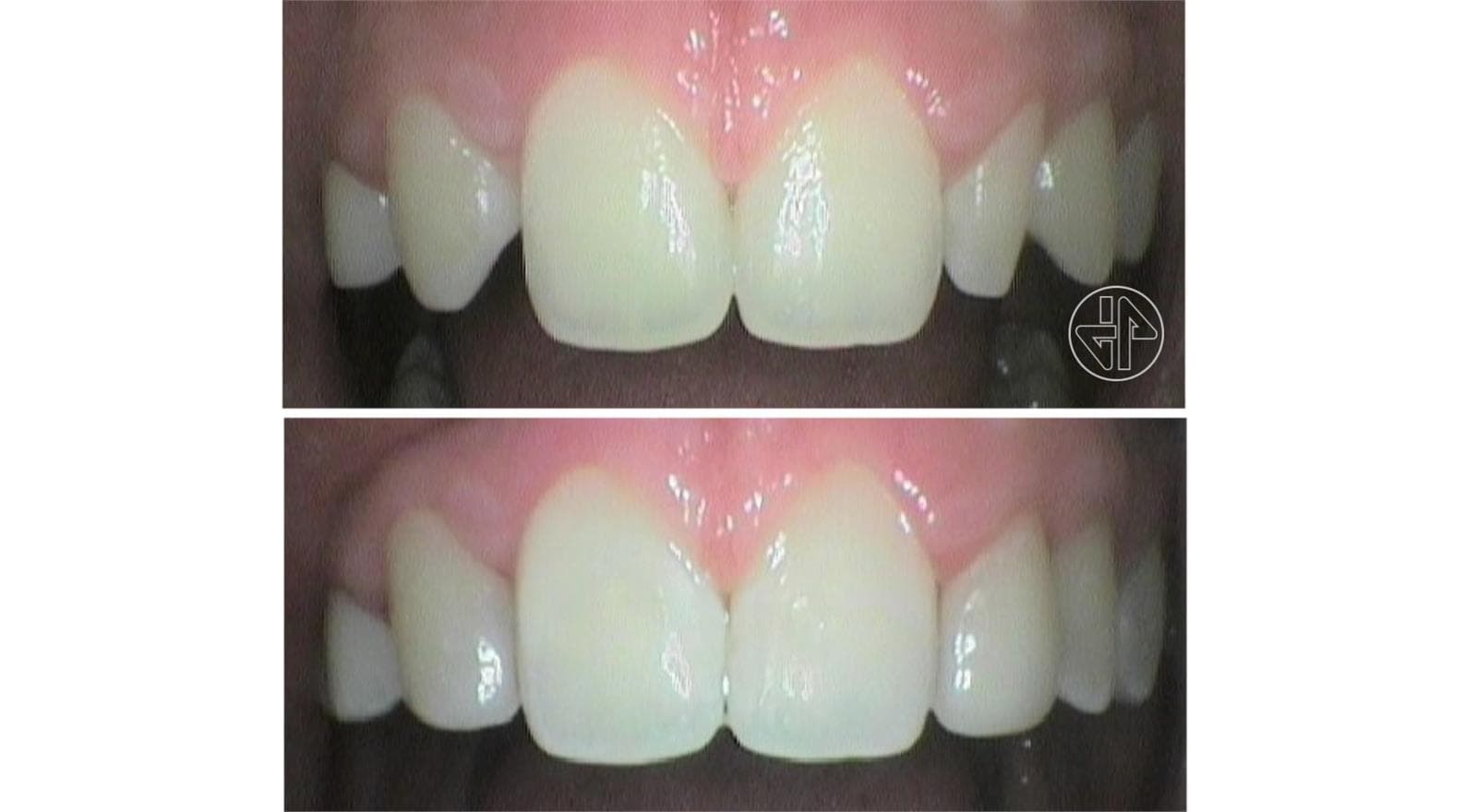 Transformación Dental - Imagen 3
