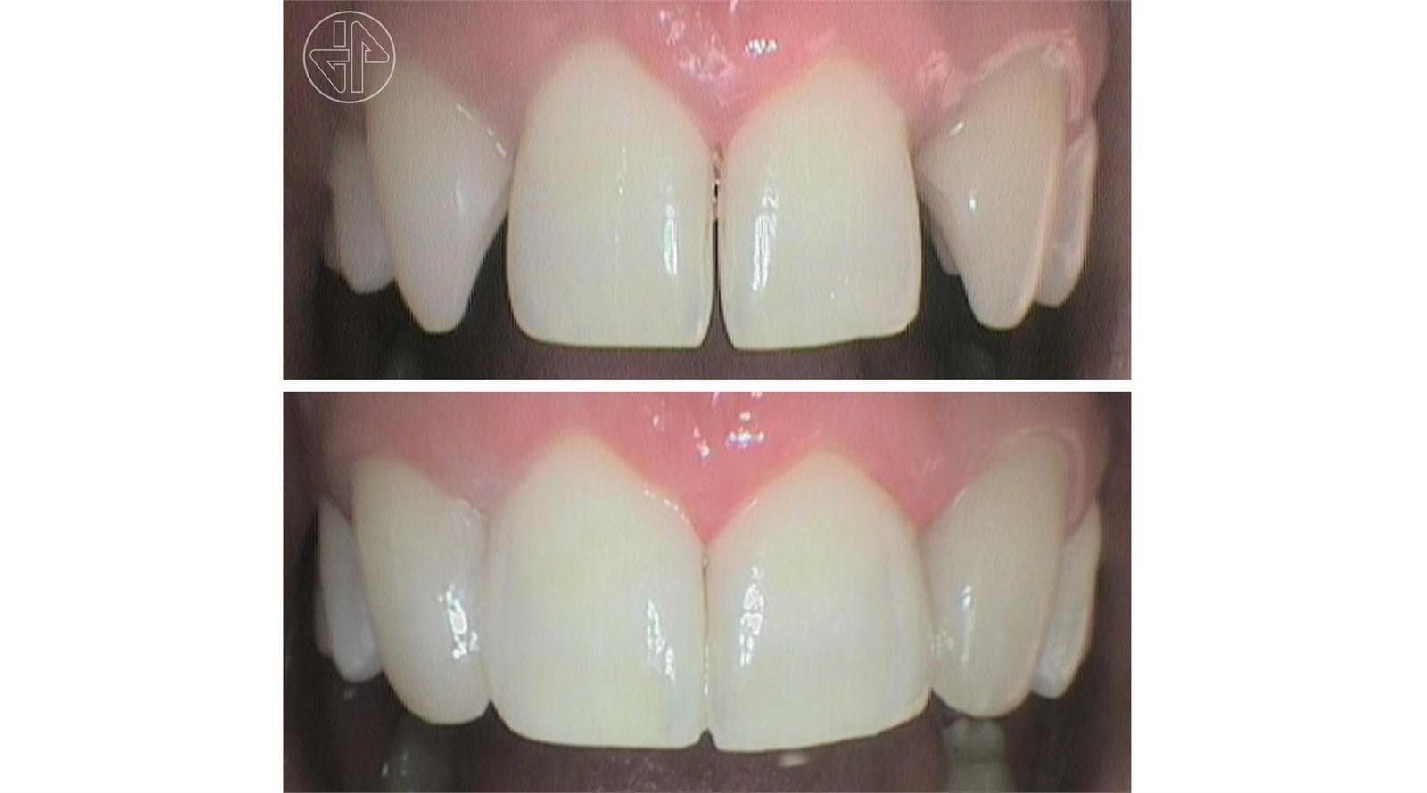 Transformación Dental - Imagen 2