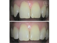 Transformación Dental