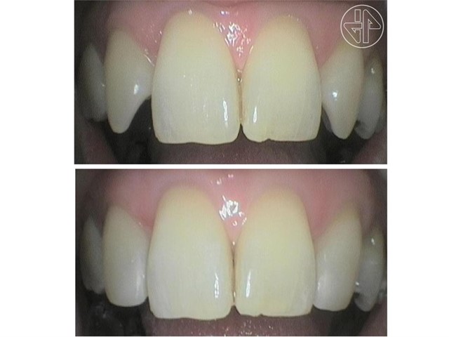 Transformación Dental